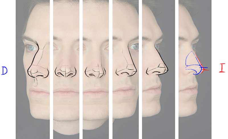 Anatomía de la nariz, estudio del Dr. Rubén Guilarte, dibujo cirujano plástico